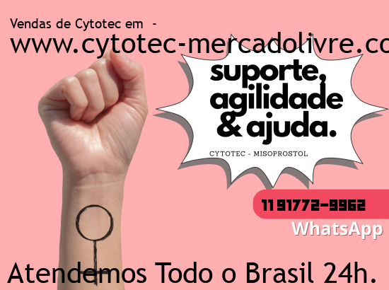 Imagem de Areal