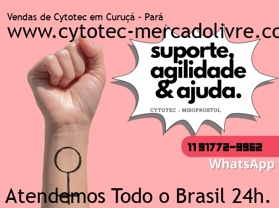Imagem de Forquilha